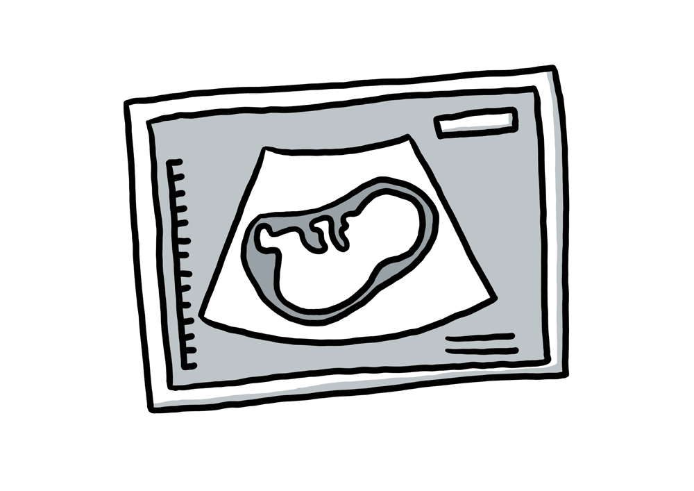 Schwangerschaft  & Geburt